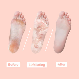 Chamos Acaci Monster Foot Peeling Pack