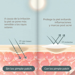 Mizon Good Bye Blemish Clear Patch