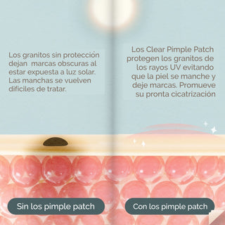 Mizon Good Bye Blemish Clear Patch